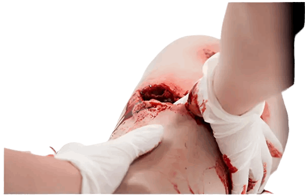 Simbodies Thigh Wound Packing Trainer - Simbodies