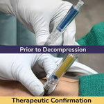 MedSource NIK Kit – Needle Decompression Indicator Kit (3.25 in) - MedSource Labs