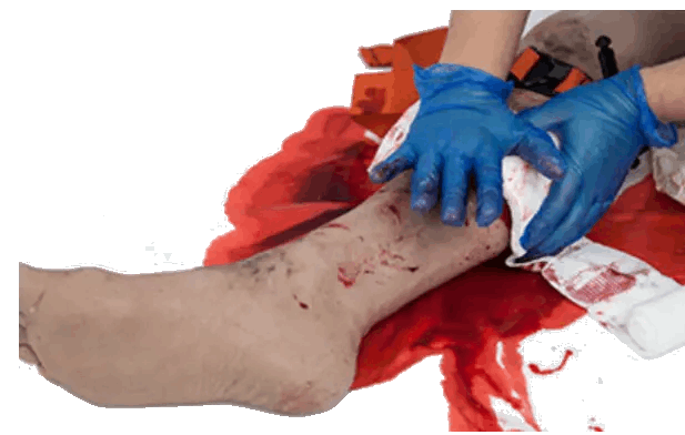 Simbodies Full Leg Major Injury Task Trainer - Simbodies