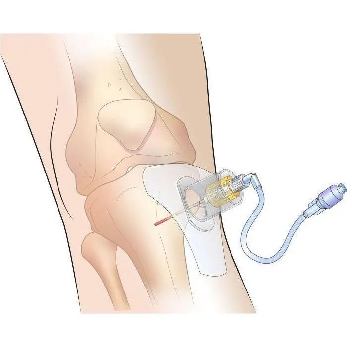 SAM IO Driver Stabilizer - SAM Medical